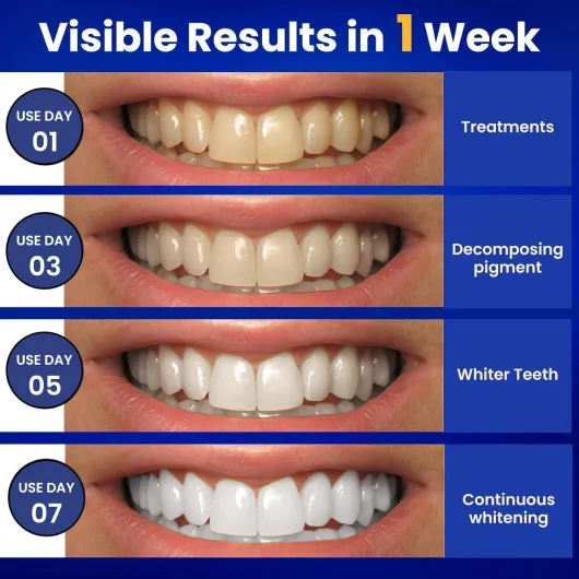 71KqoUvZ2sL._AC_SL1500_