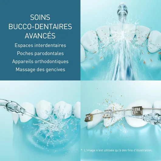 81palU0m12L._AC_SL1500_