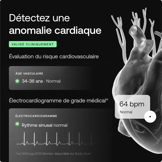 81 m9J S2xL._SL1500_